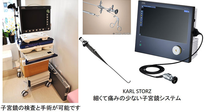 子宮鏡