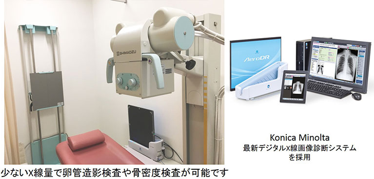 X線画像診断システム